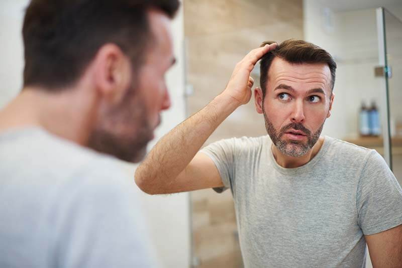 mature-men-is-worried-about-hair-loss-D83NCF2 800x